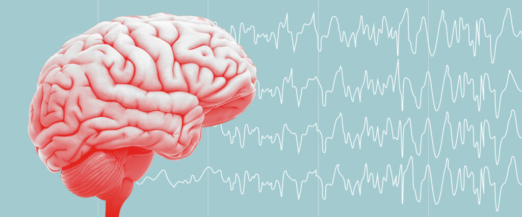 دریچه تازه‌ای به دنیای علوم اعصاب: ایمپلنت مغزی‌ای که تشنج و وسواس را کنترل می‌کند!