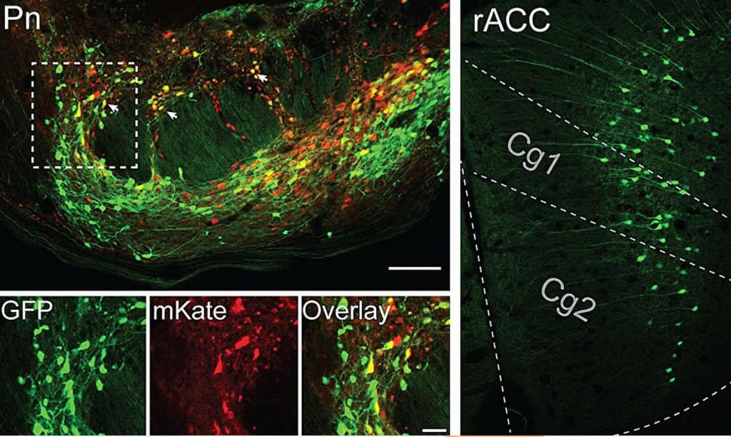 اثر داروی تلقینی؛ چگونه مغز خود را برای تسکین درد فریب میدهد؟