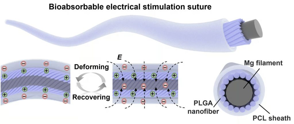 بخیههای هوشمند در زمان حرکت الکتریسیته تولید کرده و به بهبود زخمها کمک میکنند!