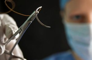 این بخیههای هوشمند در زمان حرکت، الکتریسیته تولید کرده و به بهبود زخمها کمک میکنند!