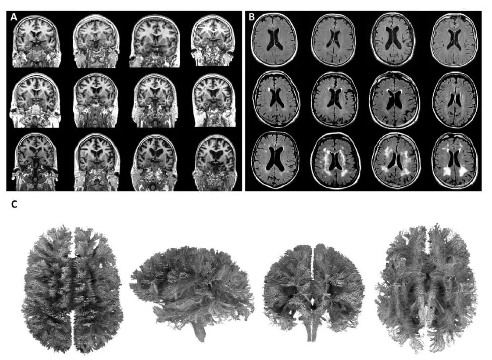 ۲۵ سال مطالعه، اسرار عملکرد شناختی کل عمر انسان را آشکار کرد!