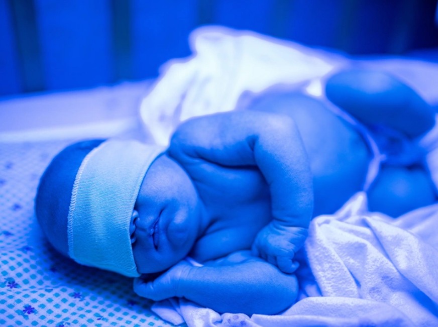 درمان خانگی نوزاد با چشم‌بند مخصوص و دستگاه زردی نوزاد