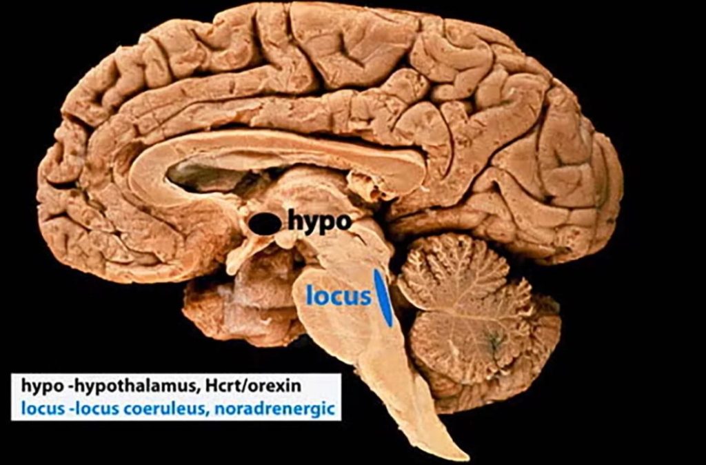 کشف "دکمه ریست حافظه" در مغز انسان!