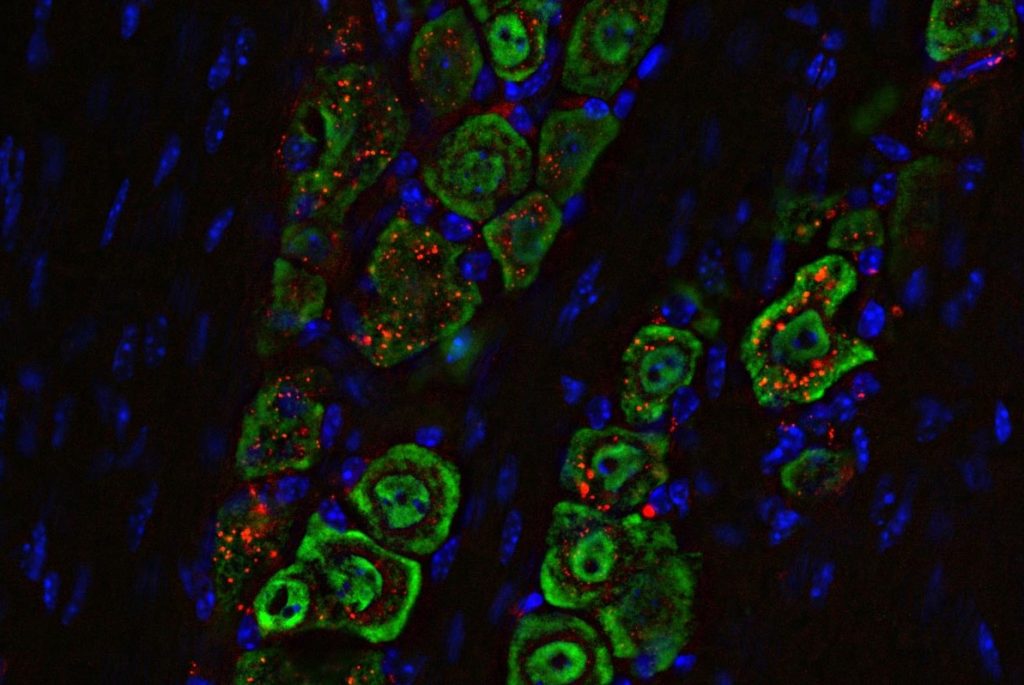 نانوقطره‌های بینی، تومورهای مغزی را در موش‌ها ریشه‌کن کردند!