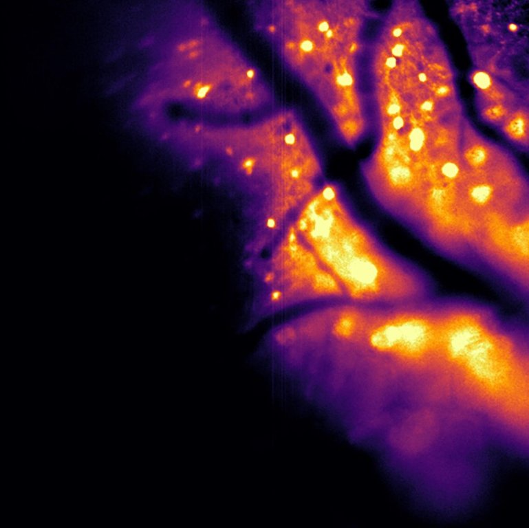 این ابزار جدید به دانشمندان اجازه می‌دهد تا فعالیت مغز را تماشا کنند!