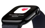 Apple Watch Series 10 42mm Aluminum