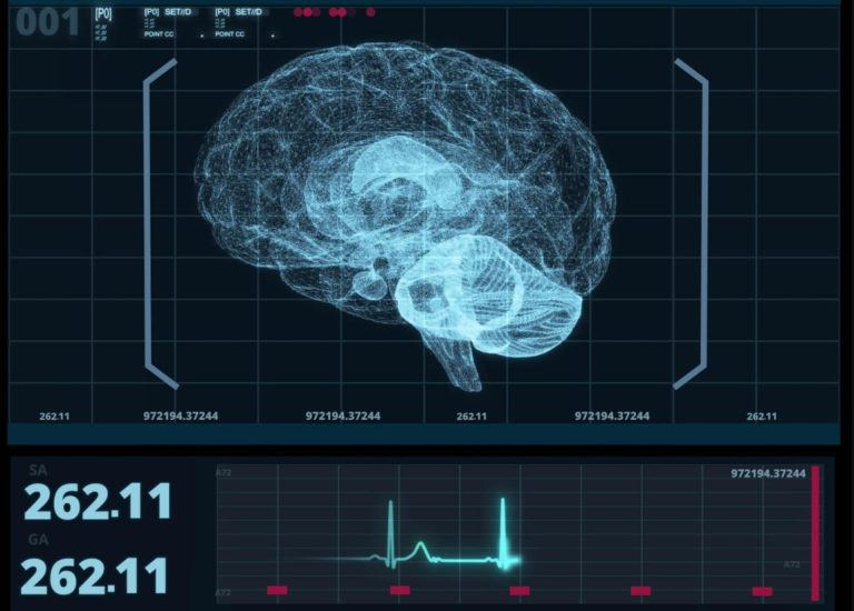 این هوش مصنوعی، اختلالات مغزی را در عرض چند ثانیه تشخیص می‌دهد