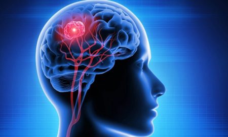 نانوقطره‌های بینی، تومورهای مغزی را در موش‌ها ریشه‌کن کردند!