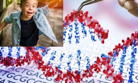 گام جسورانه فناوری کریسپر برای خاموش کردن کلید سندرم داون