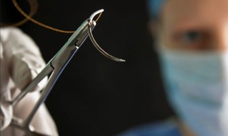 این بخیه‌های هوشمند در زمان حرکت، الکتریسیته تولید کرده و به بهبود زخم‌ها کمک می‌کنند!